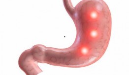 胃炎吃瓜和包米胃口疼,吃瓜與包米引發胃口疼痛